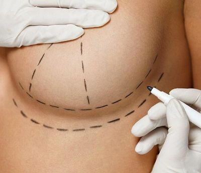 фото не тему: Пластика груди – операция, помогающая женщинам вернуть уверенность в себе
